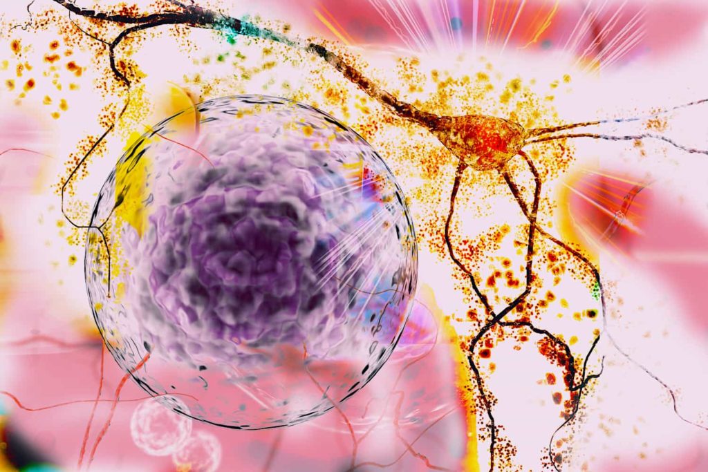 A colorful 3-D rendering of a degenerating neuron.